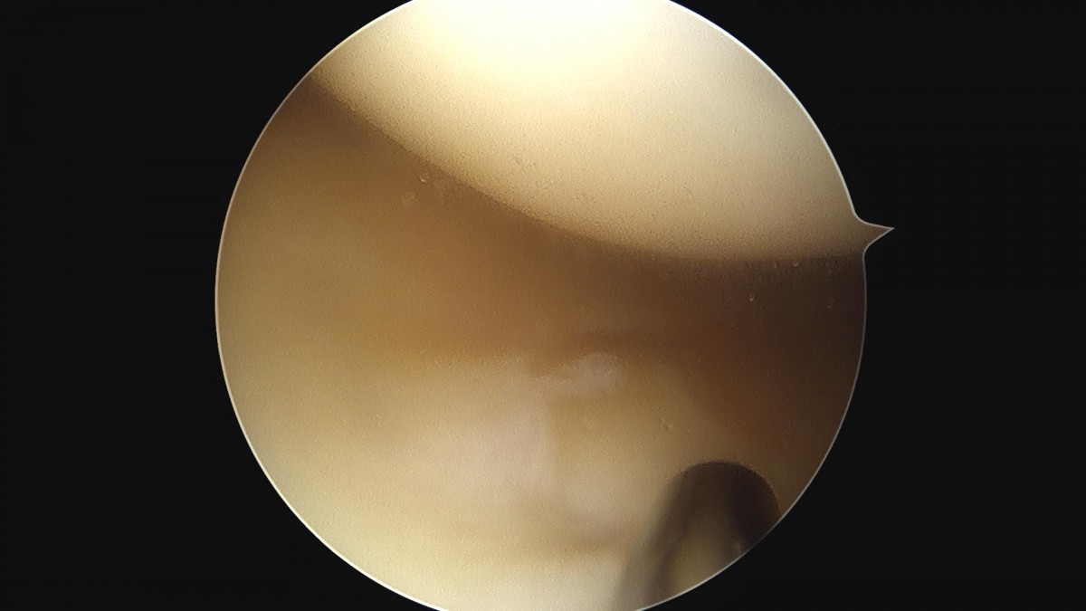 a5bb5aa2c868c534dc48e760e3eaf4b4_1720235018_1117.jpg