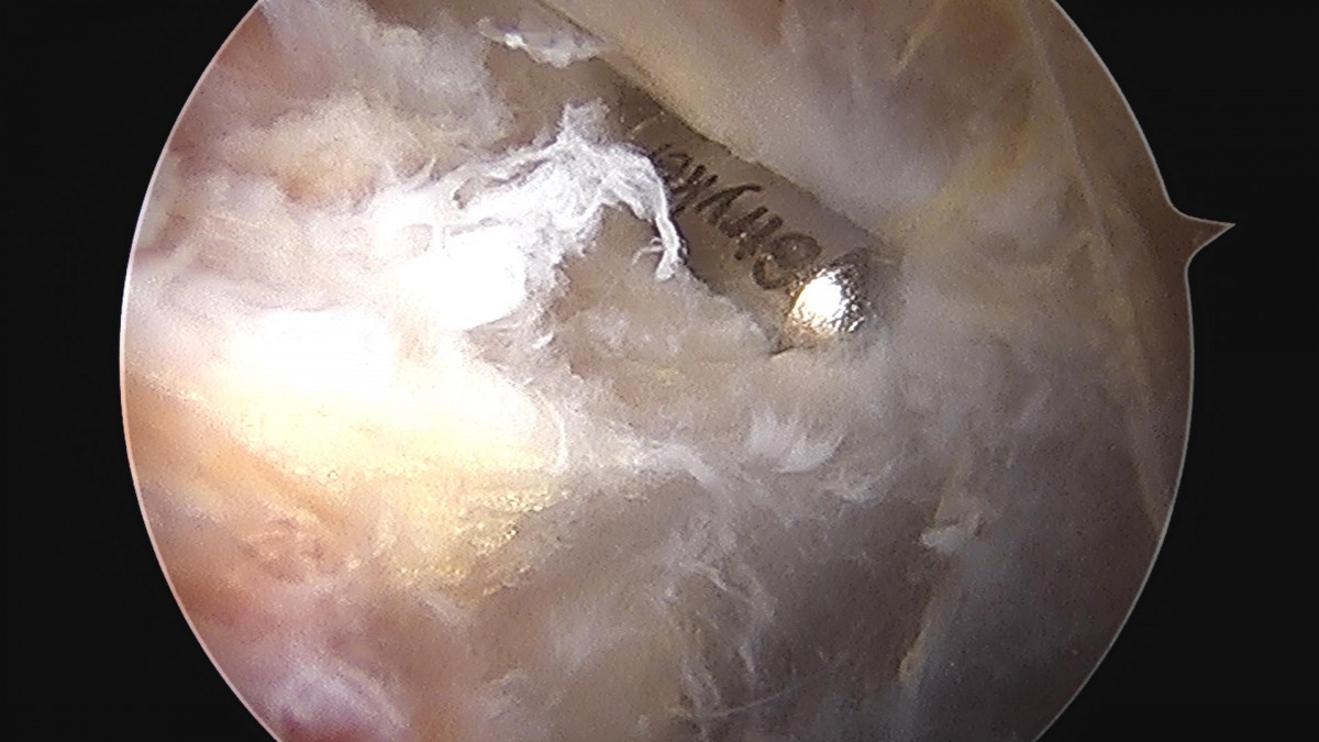 a5bb5aa2c868c534dc48e760e3eaf4b4_1720235075_4132.jpg