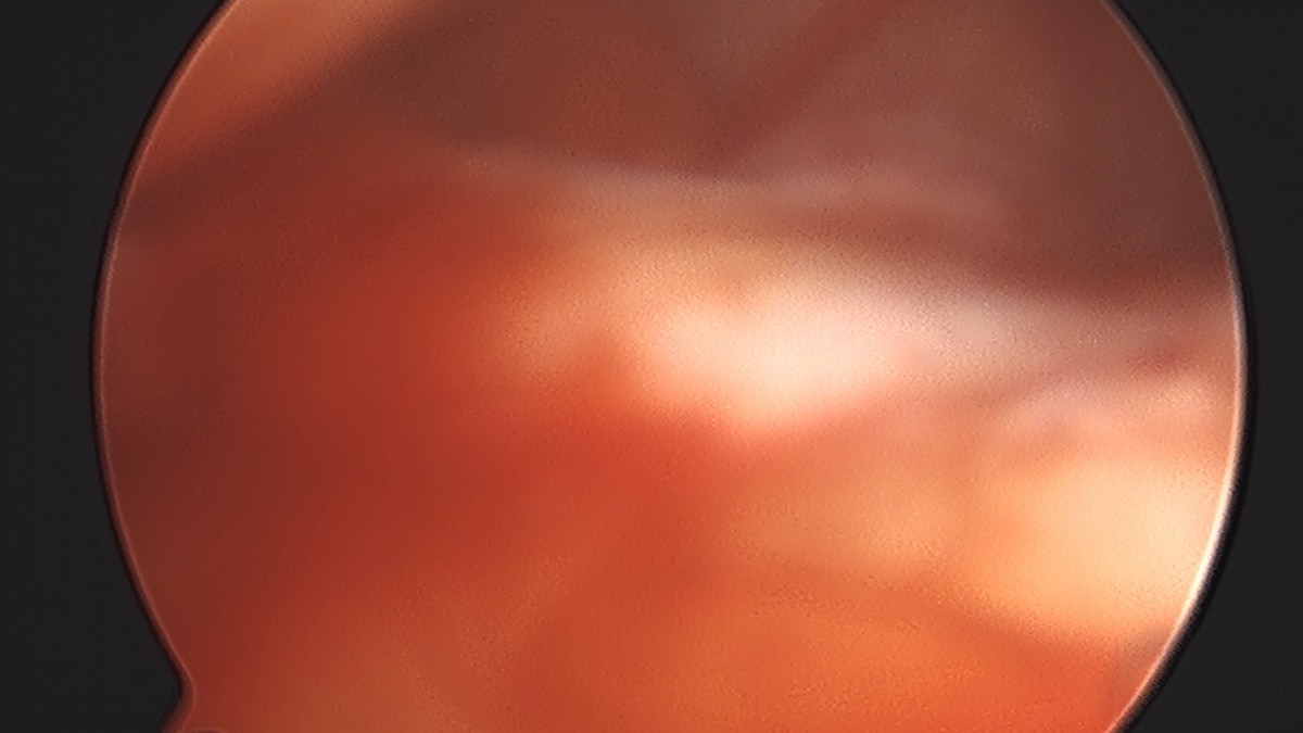 58490d3b1e200cf11df1ea881291f176_1736748188_4672.jpg