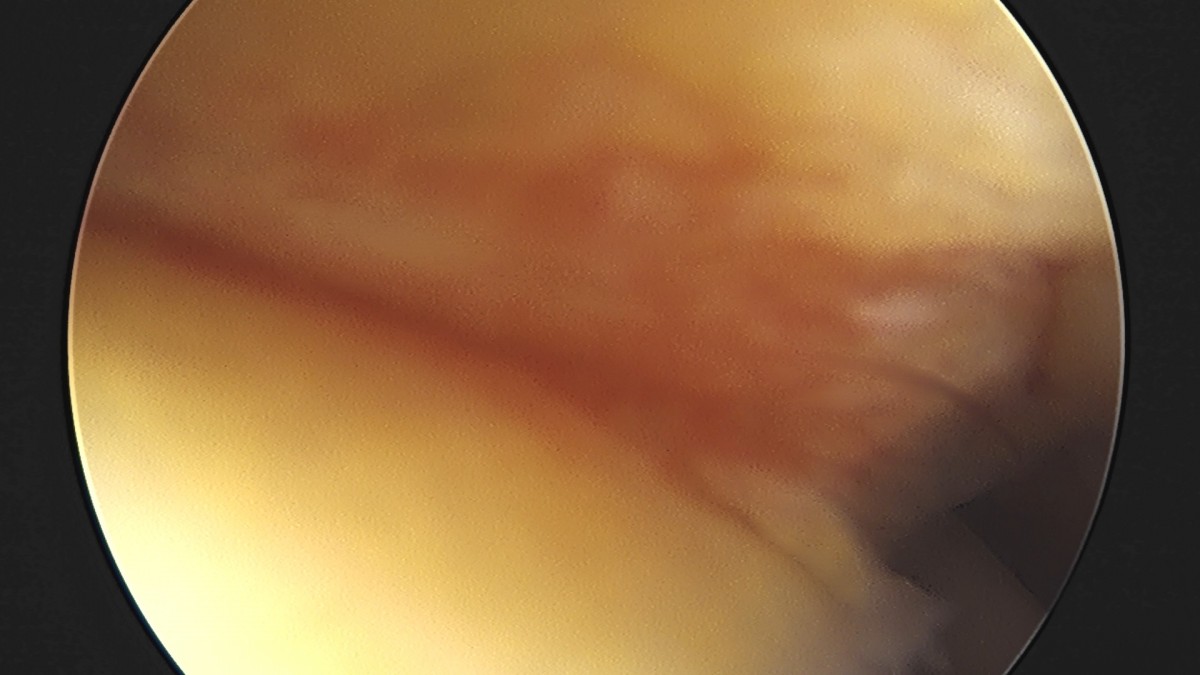 58490d3b1e200cf11df1ea881291f176_1736748188_6122.jpg
