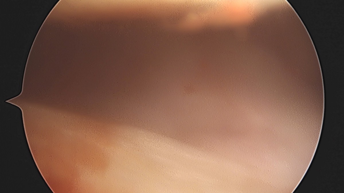 58490d3b1e200cf11df1ea881291f176_1736748188_6758.jpg