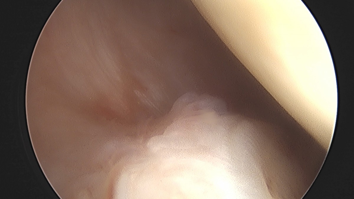 58490d3b1e200cf11df1ea881291f176_1736748188_7311.jpg