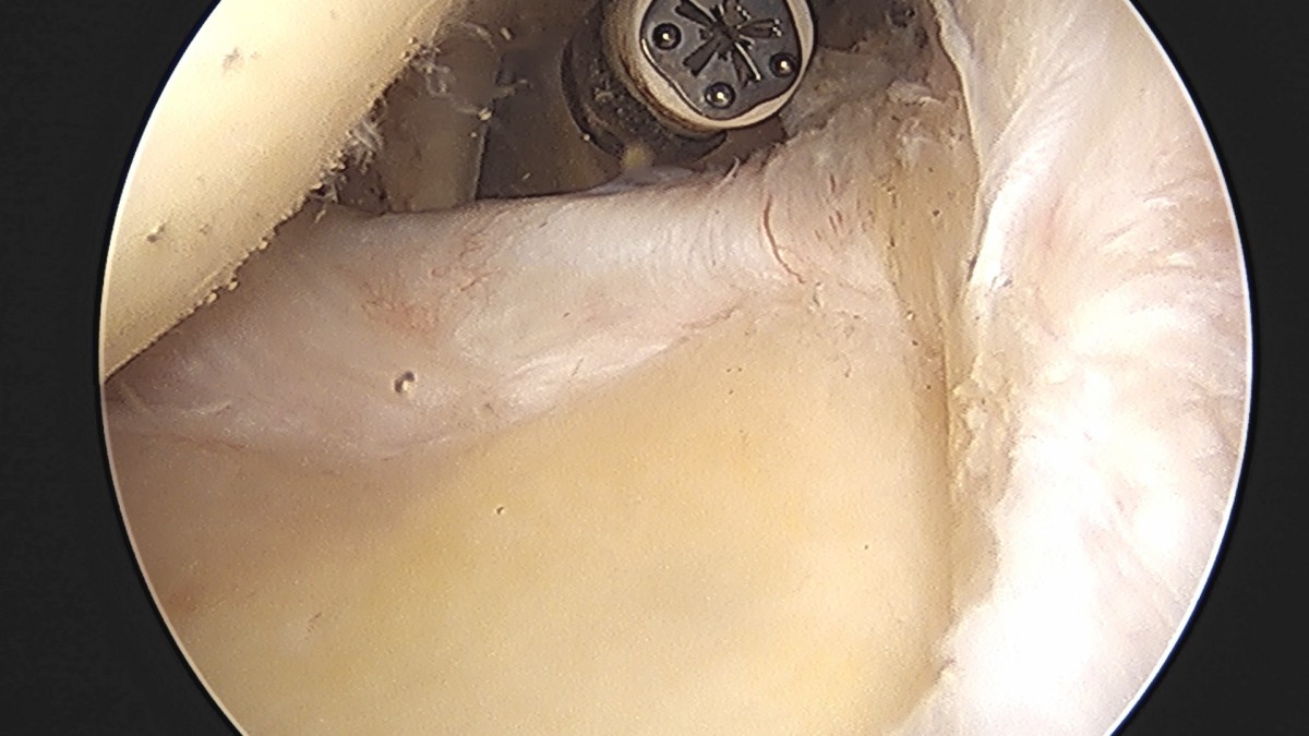 58490d3b1e200cf11df1ea881291f176_1736748188_9212.jpg