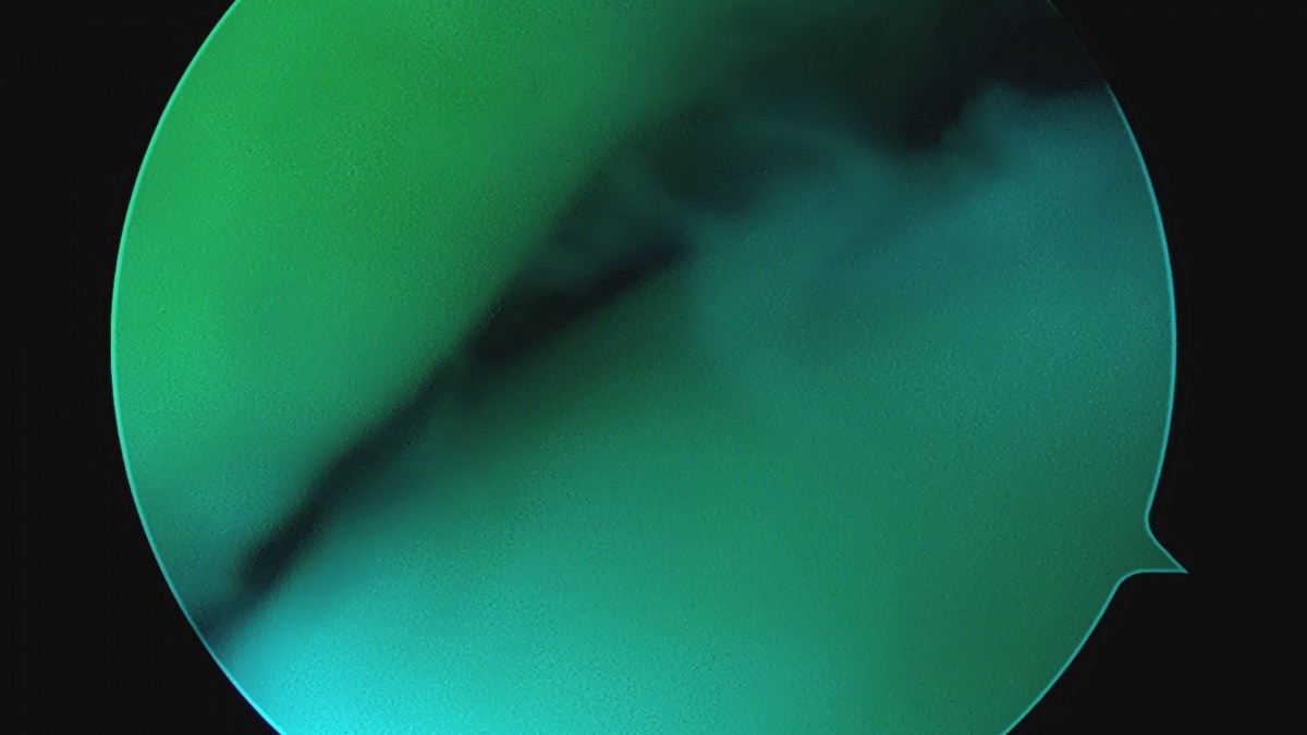 58490d3b1e200cf11df1ea881291f176_1736749770_0589.jpg