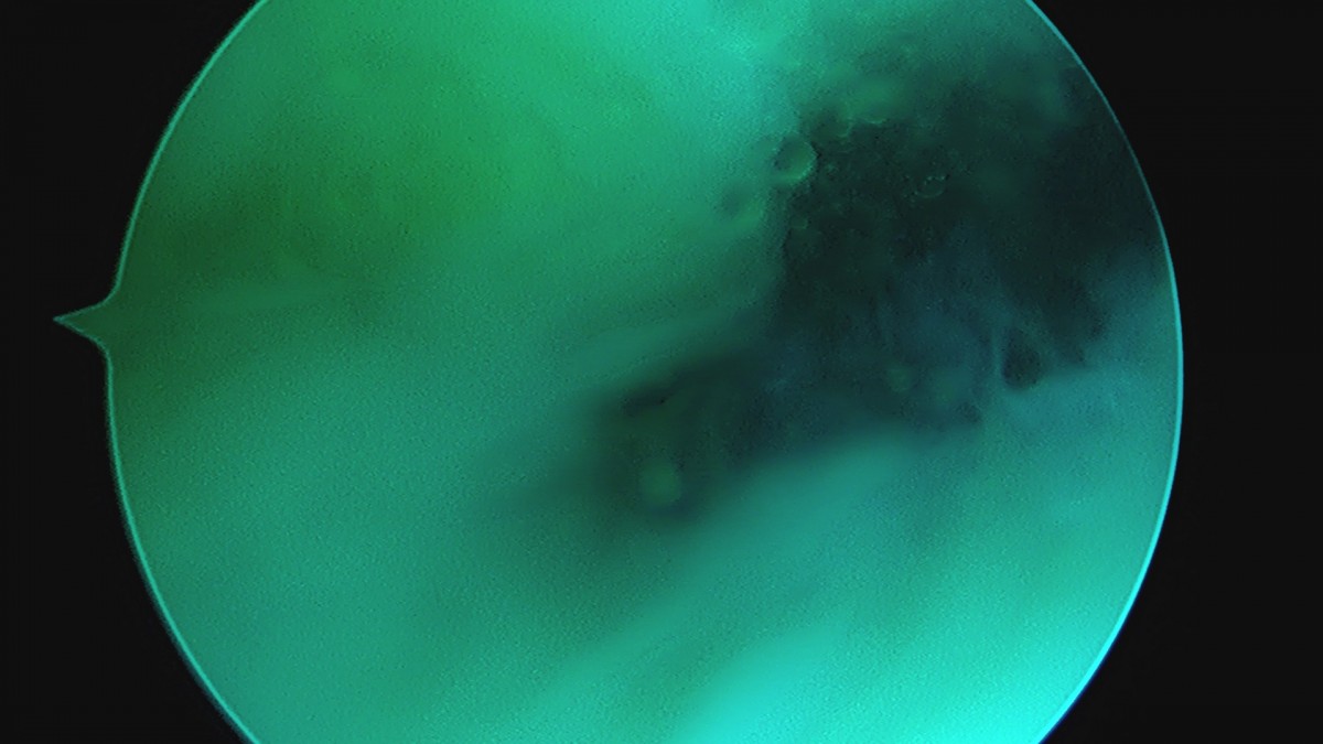 58490d3b1e200cf11df1ea881291f176_1736749770_3343.jpg