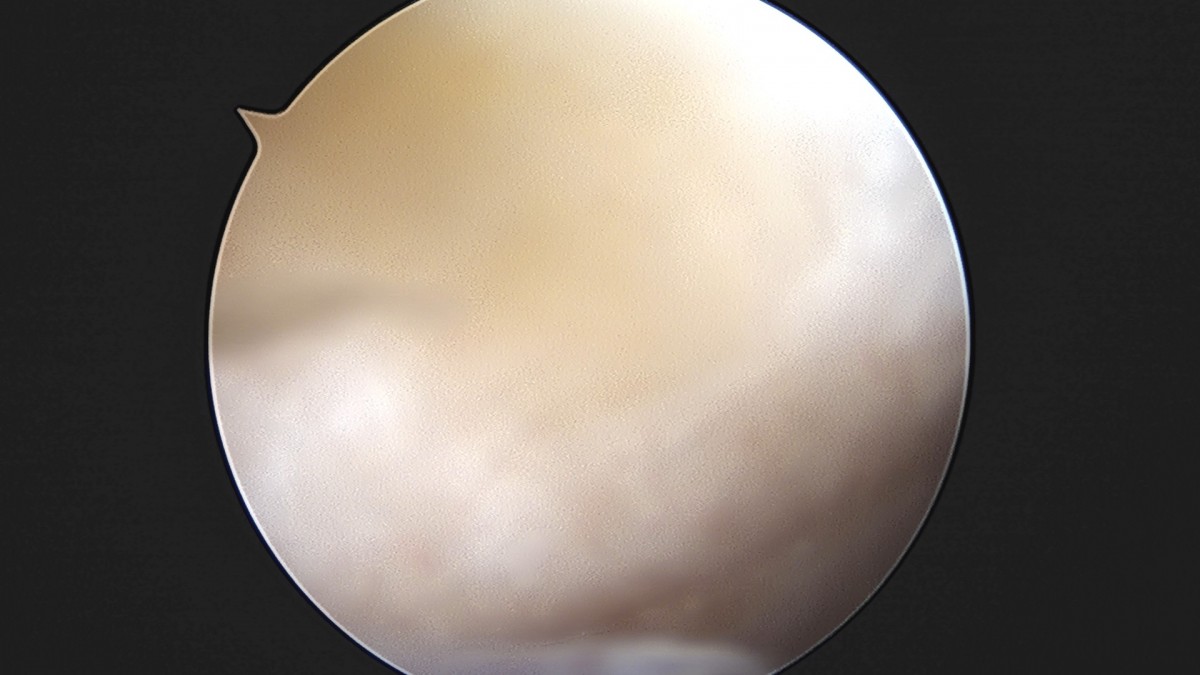 58490d3b1e200cf11df1ea881291f176_1736749825_2756.jpg