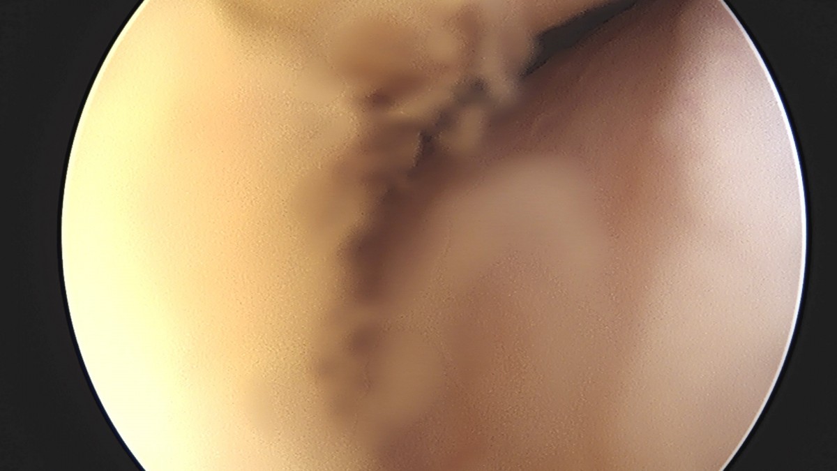 58490d3b1e200cf11df1ea881291f176_1736750859_6221.jpg