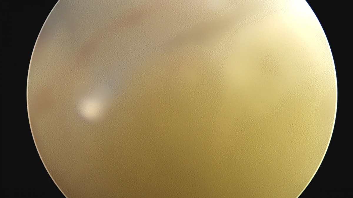 58490d3b1e200cf11df1ea881291f176_1736754696_7943.jpg