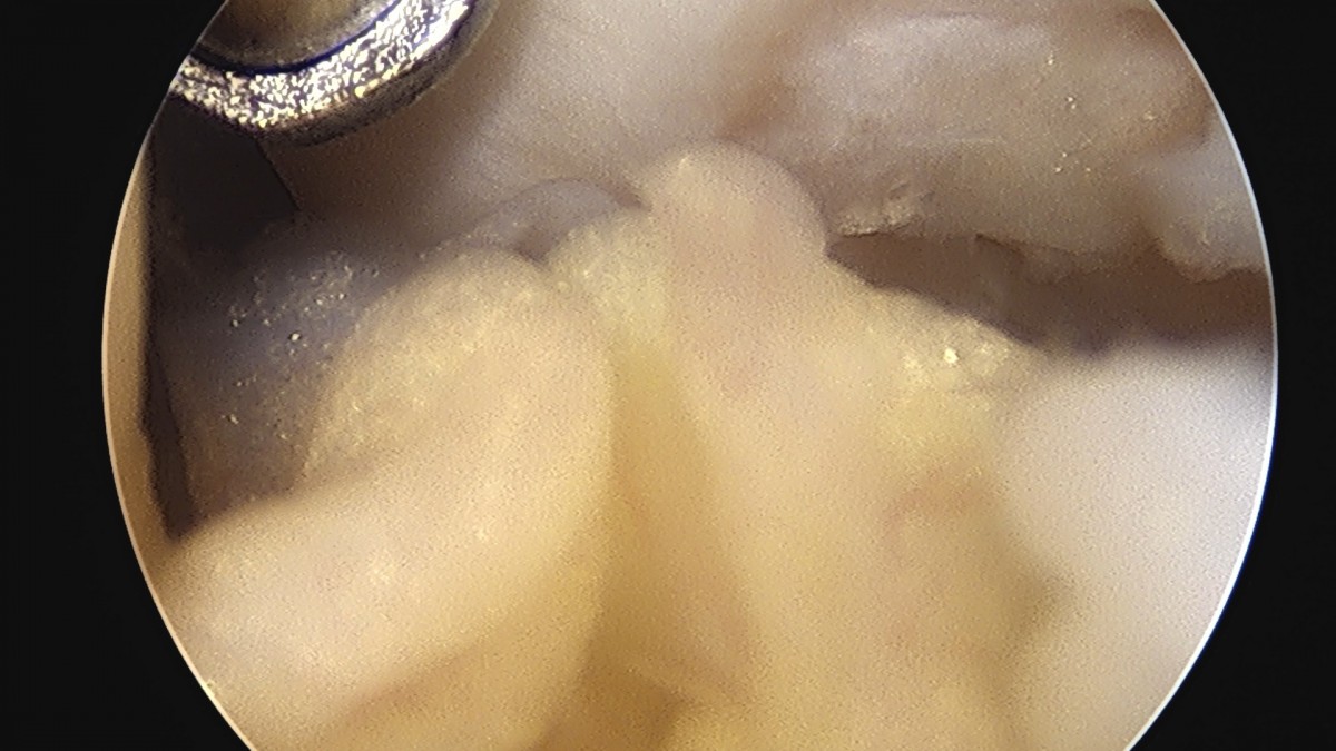 58490d3b1e200cf11df1ea881291f176_1736754696_9637.jpg
