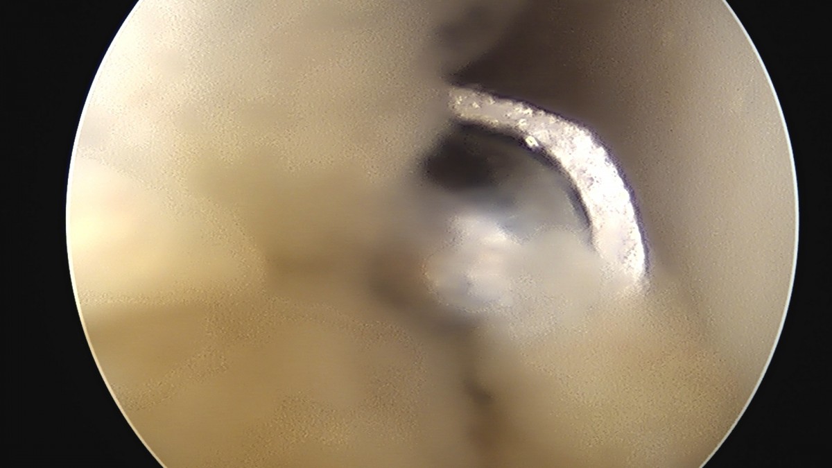 58490d3b1e200cf11df1ea881291f176_1736754697_2823.jpg