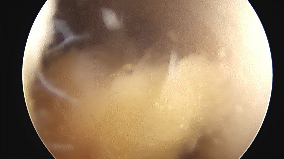 58490d3b1e200cf11df1ea881291f176_1736754697_3568.jpg