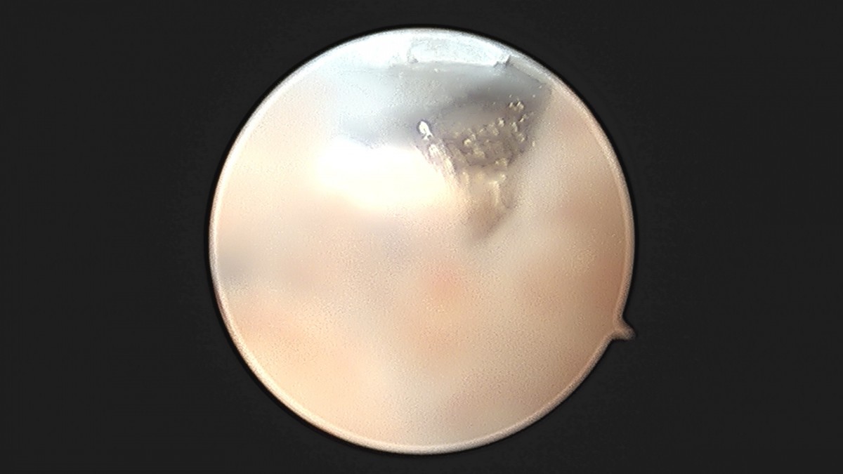 58490d3b1e200cf11df1ea881291f176_1736755060_3147.jpg