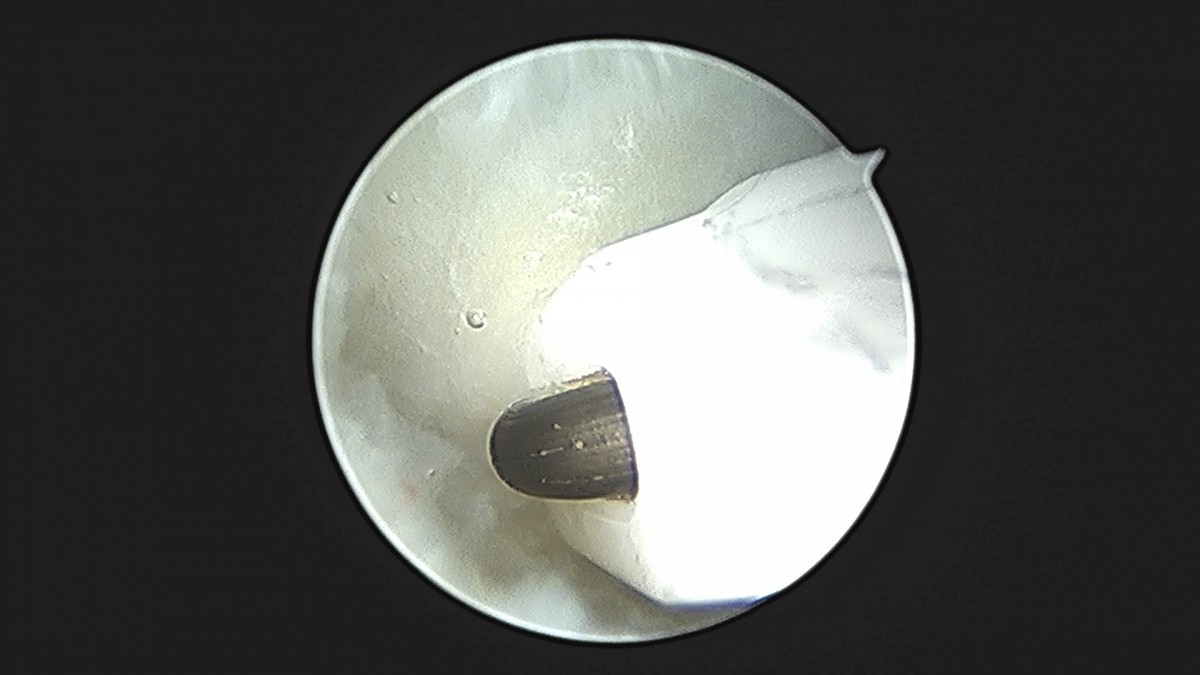58490d3b1e200cf11df1ea881291f176_1736755061_0151.jpg