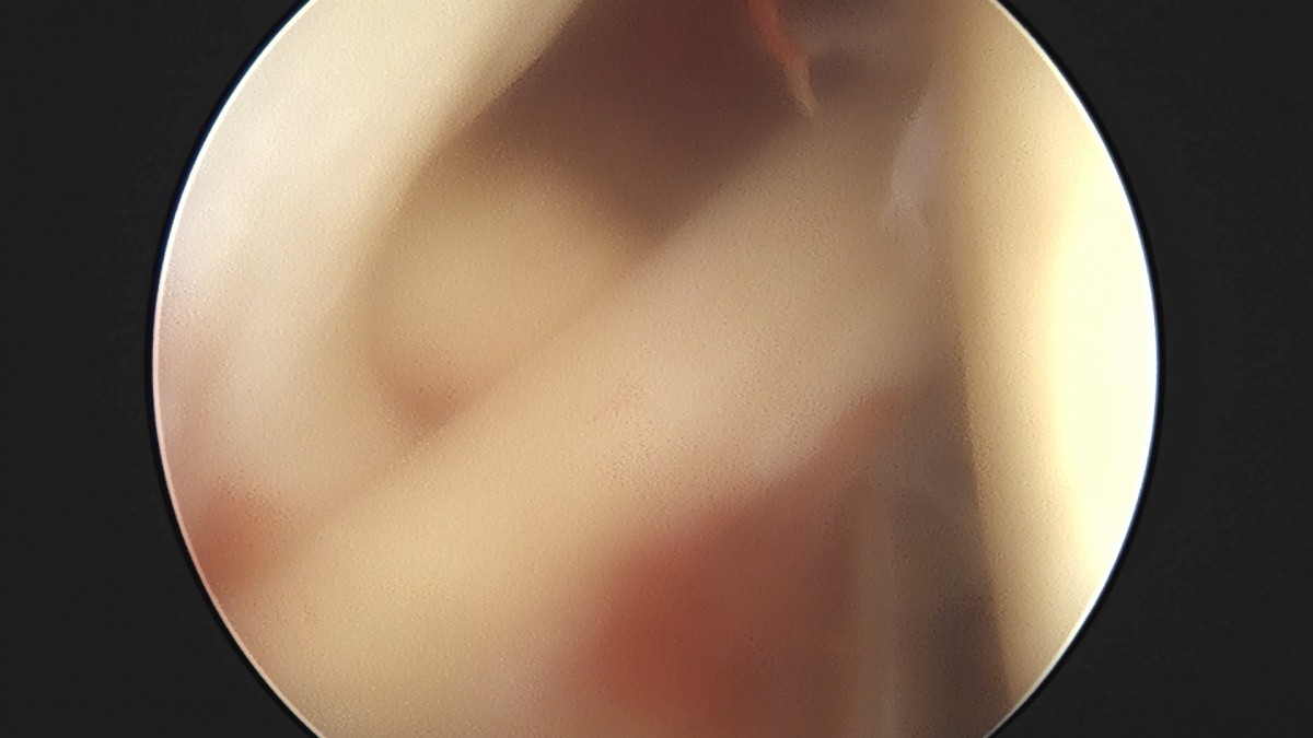 7a726e8ef38f0b72b0e256e4cd430ad9_1747294720_0542.jpg